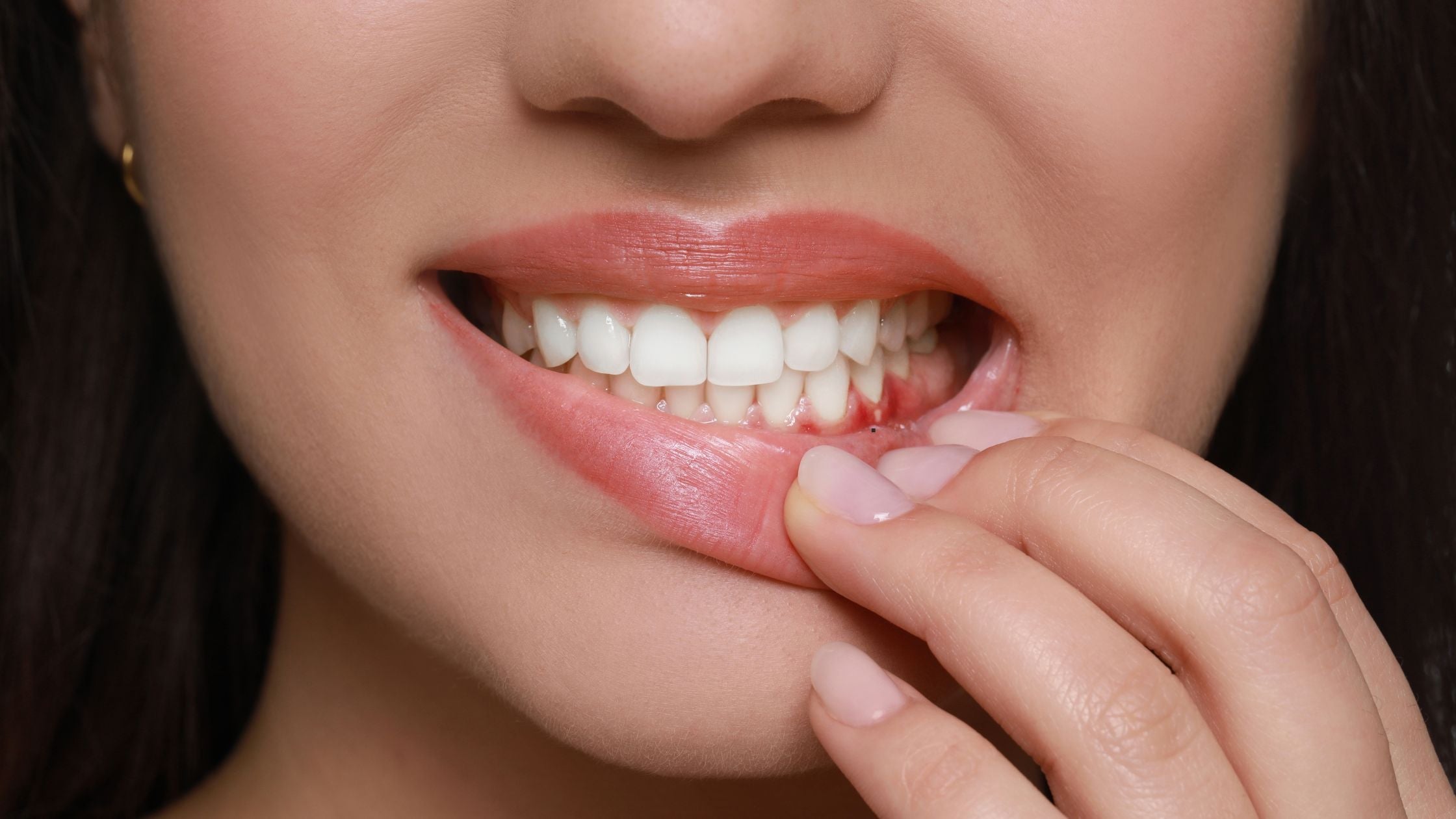Why Is My Gum Growing Over My Tooth? Reason And Treatment